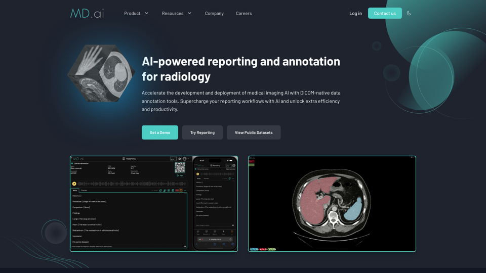 MD.ai | AI-powered reporting and annotation for radiology